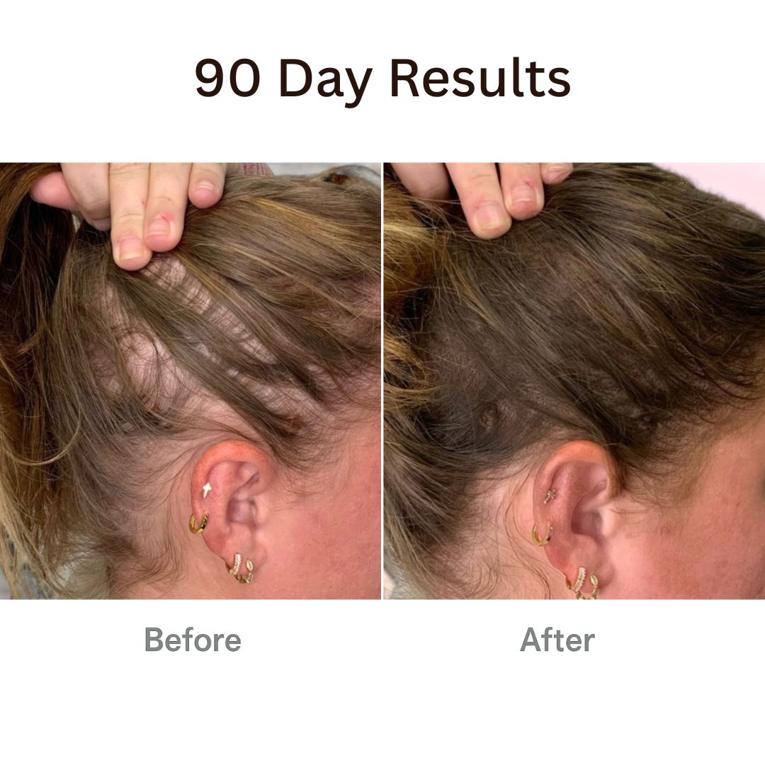 Folyx™ The Ultimate 4-in-1 Hair Therapy Brush