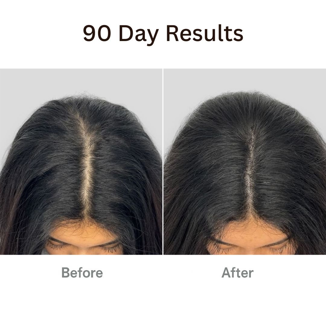 Folyx™ The Ultimate 4-in-1 Hair Therapy Brush