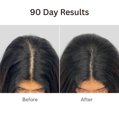 Folyx™ The Ultimate 4-in-1 Hair Therapy Brush